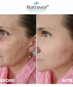 Natravor® Freeze-Dried Anti-Wrinkle Nano-Silk Collagen