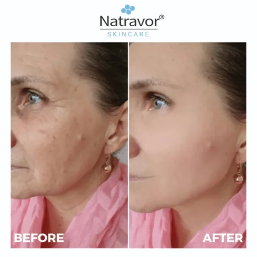 Natravor® Freeze-Dried Anti-Wrinkle Nano-Silk Collagen