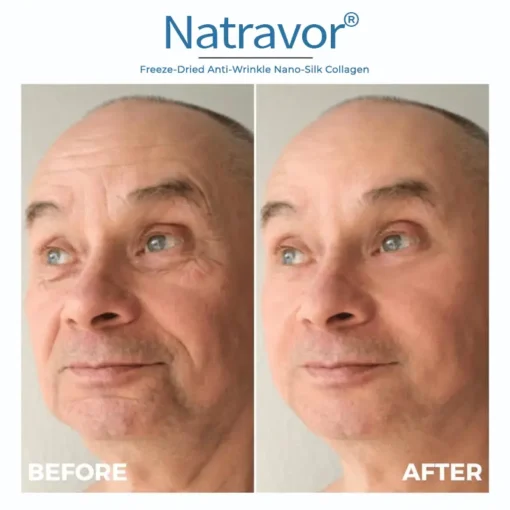 Natravor® Freeze-Dried Anti-Wrinkle Nano-Silk Collagen
