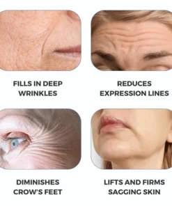 Natravor® Freeze-Dried Anti-Wrinkle Nano-Silk Collagen