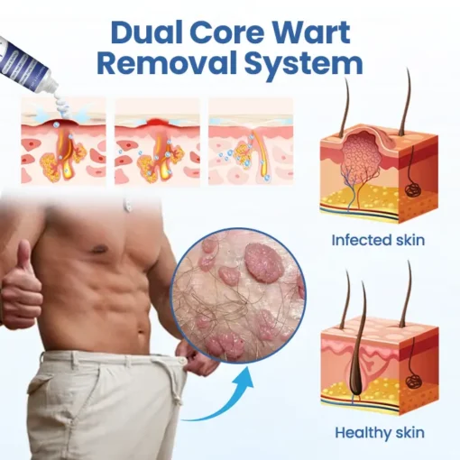 Natravor® GentX WartRelief Cream