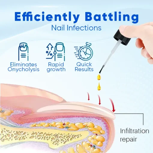 Natravor® OnyxoGuard Nail Growth and Repair Serum