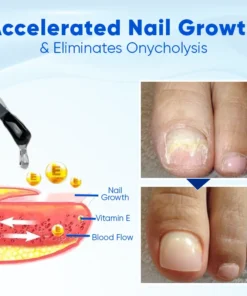 Natravor® OnyxoGuard Nail Growth and Repair Serum