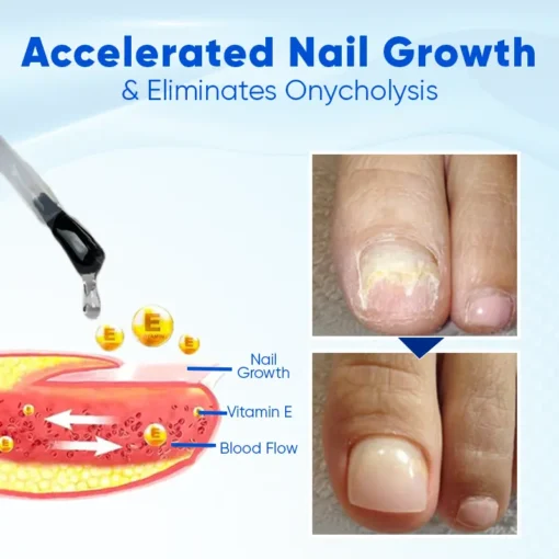 Natravor® OnyxoGuard Nail Growth and Repair Serum