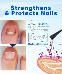 Natravor® OnyxoGuard Nail Growth and Repair Serum