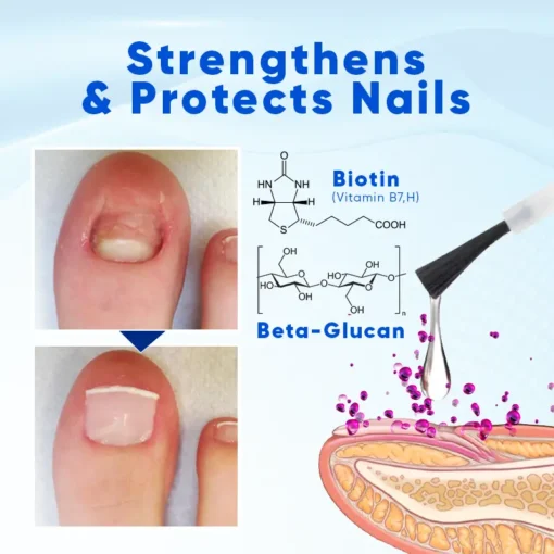 Natravor® OnyxoGuard Nail Growth and Repair Serum