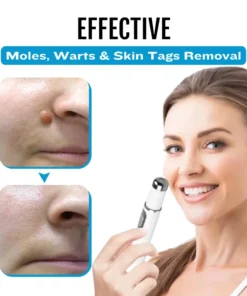 Natravor® SpotlessDerm Mole and Wart Laser Pen