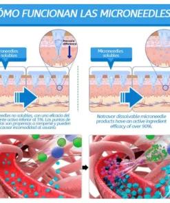 Natravor™ con SMGT-GLP-1 y Matrixyl 3000