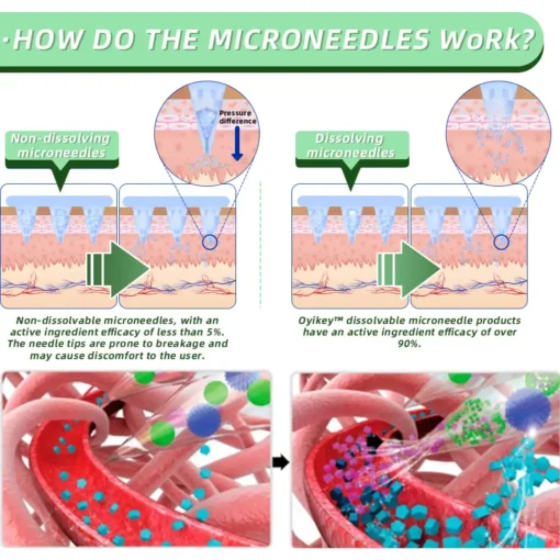 Natravor® SMGT-GLP-1 Nano Microneedle Patch