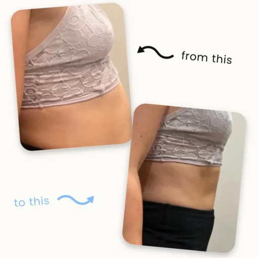 Natravor™ Slimming Patches