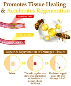 𝐍𝐚𝐭𝐫𝐚𝐯𝐨𝐫™ 𝐁𝐞𝐞 𝐕𝐞𝐧𝐨𝐦 Treatment Cream