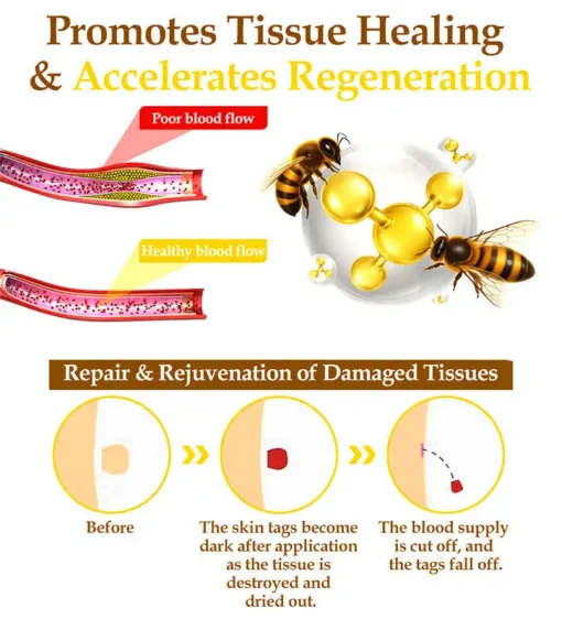 𝐍𝐚𝐭𝐫𝐚𝐯𝐨𝐫™ 𝐁𝐞𝐞 𝐕𝐞𝐧𝐨𝐦 Treatment Cream