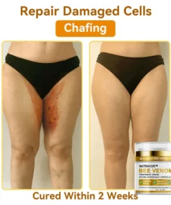 𝐍𝐚𝐭𝐫𝐚𝐯𝐨𝐫™ 𝐁𝐞𝐞 𝐕𝐞𝐧𝐨𝐦 Treatment Cream