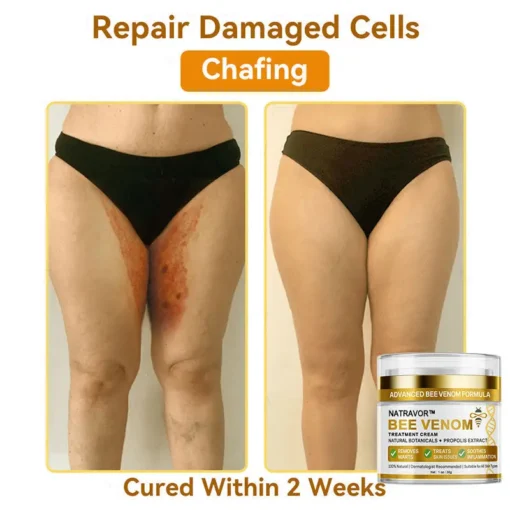 𝐍𝐚𝐭𝐫𝐚𝐯𝐨𝐫™ 𝐁𝐞𝐞 𝐕𝐞𝐧𝐨𝐦 Treatment Cream