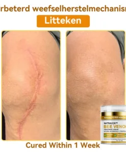 𝐍𝐚𝐭𝐫𝐚𝐯𝐨𝐫™ 𝐁𝐞𝐞 𝐕𝐞𝐧𝐨𝐦 Treatment Cream