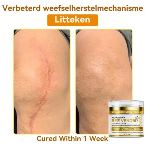 𝐍𝐚𝐭𝐫𝐚𝐯𝐨𝐫™ 𝐁𝐞𝐞 𝐕𝐞𝐧𝐨𝐦 Treatment Cream