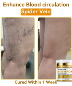 𝐍𝐚𝐭𝐫𝐚𝐯𝐨𝐫™ 𝐁𝐞𝐞 𝐕𝐞𝐧𝐨𝐦 Treatment Cream