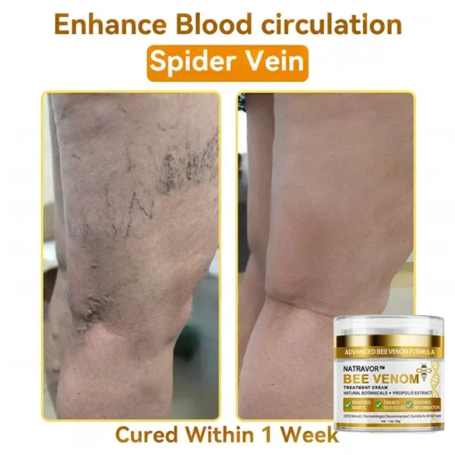 𝐍𝐚𝐭𝐫𝐚𝐯𝐨𝐫™ 𝐁𝐞𝐞 𝐕𝐞𝐧𝐨𝐦 Treatment Cream