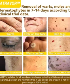 𝐍𝐚𝐭𝐫𝐚𝐯𝐨𝐫™ 𝐁𝐞𝐞 𝐕𝐞𝐧𝐨𝐦 Treatment Cream