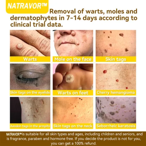 𝐍𝐚𝐭𝐫𝐚𝐯𝐨𝐫™ 𝐁𝐞𝐞 𝐕𝐞𝐧𝐨𝐦 Treatment Cream