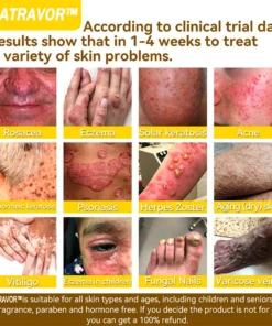 𝐍𝐚𝐭𝐫𝐚𝐯𝐨𝐫™ 𝐁𝐞𝐞 𝐕𝐞𝐧𝐨𝐦 Treatment Cream