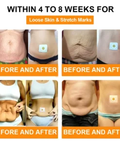 NATRAVOR™ Bee Lymphatic Drainage Slimming Patch