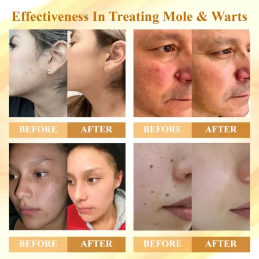 Natravor® Condense Mellifera Venom Skin Repairing Cream