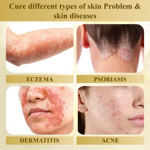 Natravor® Condense Mellifera Venom Skin Repairing Cream