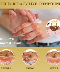 Natravor® Condense Mellifera Venom Skin Repairing Cream