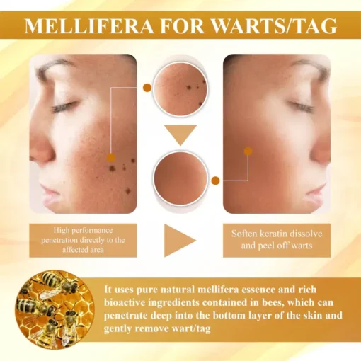 Natravor® Condense Mellifera Venom Skin Repairing Cream