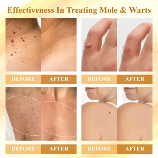 Natravor® Condense Mellifera Venom Skin Repairing Cream