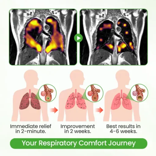Natravor® HerbaAir Mullein Lung Purifier
