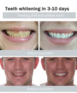 Natravor™Miracle Tooth Powder