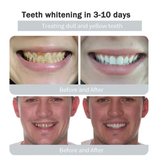 Natravor™Miracle Tooth Powder