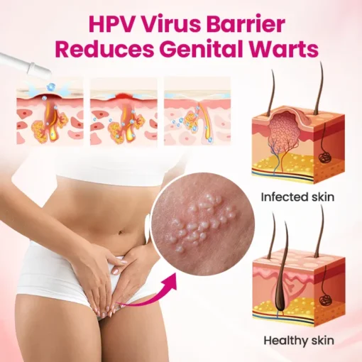 Natravor® IntiDefend Anti-HPV Interferon Gel - Image 4