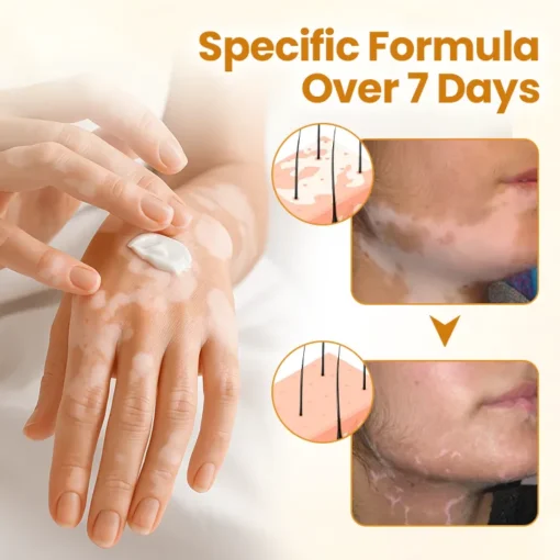 Natravor® VitiCalm Bee Venom Cream - Image 3