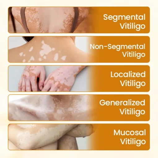 Natravor® VitiCalm Bee Venom Cream - Image 4