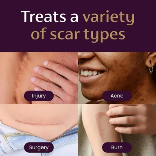 Natravor® Advanced Scar Gel - Image 2