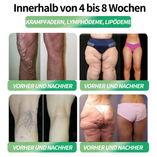Natravor® NAD 6-in-1 Gesundheits-Orallösung
