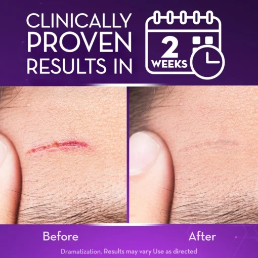 Natravor® Advanced Scar Gel - Image 4