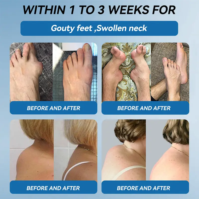 NATRAVOR® BPC-157 Joint Healing Cream