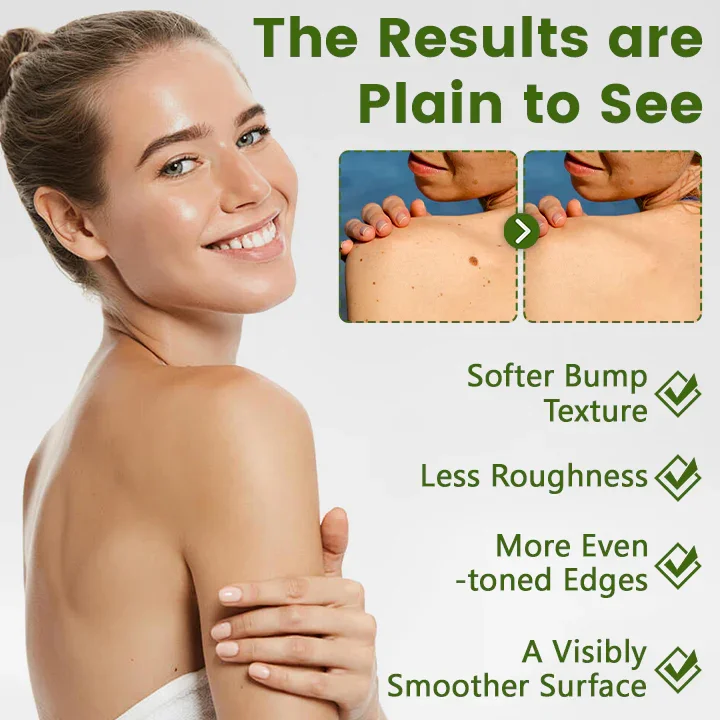 NATRAVOR® ThujaClear Botanical Wart Cream - Image 4