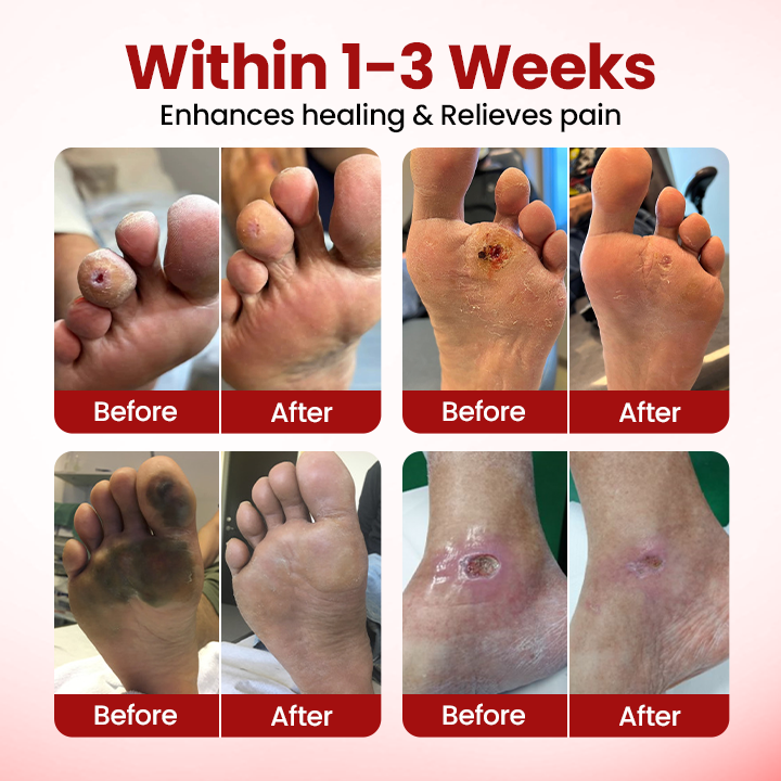 NATRAVOR® VitaGluco Diabetic Care Cream - Image 2