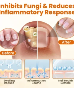 NATRAVOR® FungiBee Advanced Nail Repair Spray