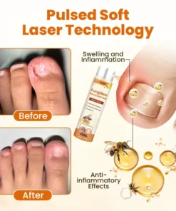 NATRAVOR® FungiBee Advanced Nail Repair Spray