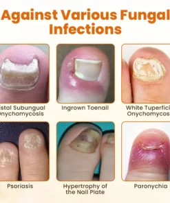 NATRAVOR® FungiBee Advanced Nail Repair Spray