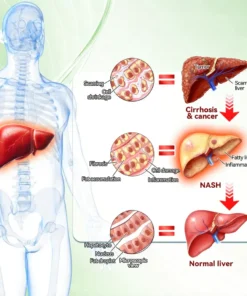 NATRAVOR® 𝑴𝒆𝒕𝒂𝒃𝒐𝒍𝒊𝒄 𝑵𝒂𝒏𝒐 𝑴𝒊𝒄𝒓𝒐𝒏𝒆𝒆𝒅𝒍𝒆 𝑷𝒂𝒕𝒄𝒉