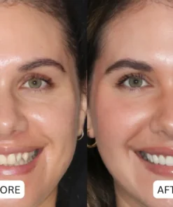 NATRAVOR® Teeth Armor Drops