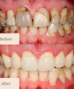 NATRAVOR® Teeth Armor Drops