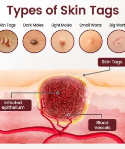 Natravor® BumpAway Gentle Renewal Cream